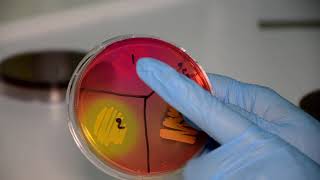 The Staphylococci and The Streptococci Microbiology Laboratory Practical Part [upl. by Eixel310]