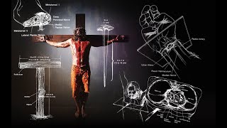 Jesus’ Suffering and Crucifixion  A Medical Point of View [upl. by Eldora116]