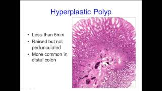 Early 4 Signs to Confirm Pregnancy Implantation bleeding VS PMS  Dr Samina Toufeeq [upl. by Ayrad43]