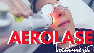 Aerolase Laser Treatment Review  AntiAging And Acne Skin Care [upl. by Regni]