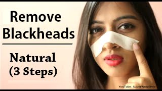 How to Remove Blackheads From Nose amp Face  Naturally at Home  Superwowstyle [upl. by Bryner]