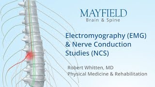 Understanding Small Fiber Neuropathies [upl. by Elatnahs]