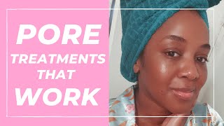 Treatment for Large Pores that WORK Black Skin [upl. by Adnole]