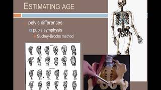 Forensic Anthropology Identifying individuals [upl. by Natsirk224]