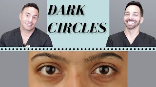 Dark Circles Causes amp Treatments  Dermatologist Perspective [upl. by Eirrot]