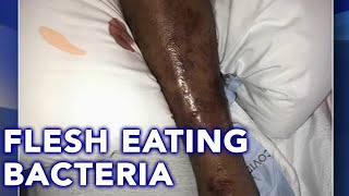 Flesh Eating Bacteria How to Euthanize a Goldfish [upl. by Amesari438]