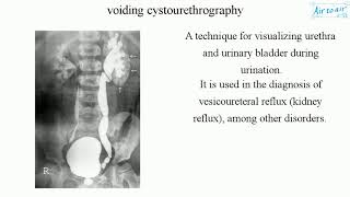 voiding cystourethrography [upl. by Marsden]