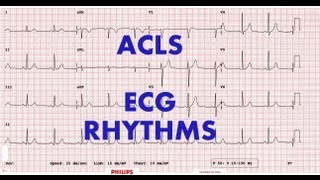 ACLS  ECG rhythm recognition amp management Part 1 [upl. by Niloc]