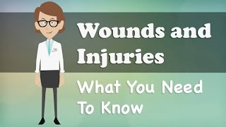 Wounds and Injuries  What You Need To Know [upl. by Michaeline]