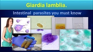 Giardia lambliaLife cycleStructureLabdiagnosisGiardiasisClear overview [upl. by Nohsav]