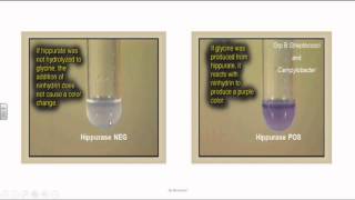 Group B Streptococci or Streptococcus Agalactia [upl. by Nomahs349]