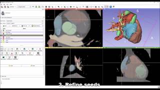 Whole heart segmentation from cardiac CT in 10 minutes [upl. by Lowry569]