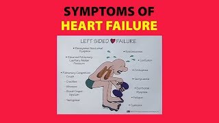 Symptoms of Heart Failure [upl. by Bigod]