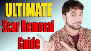 Scar Removal Products That Work  ULTIMATE Product Guide  Chris Gibson [upl. by Wolsky]