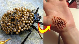 Top 10 Insectos Y Arácnidos Más Peligrosos Del Mundo [upl. by Thissa]