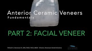 Anterior Ceramic Veneers Part 2 Facial Veneer [upl. by Rudolfo]