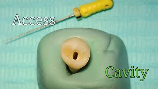 Access Cavity Preparation  Mandibular First Premolar [upl. by Eanyl]