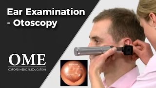 Otoscopy Ear Examination  ENT [upl. by Idorb]