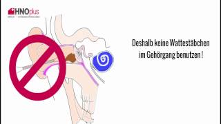 Ohrenschmalz  5 häufige Fragen aus der HNO Praxis [upl. by Mcintyre]