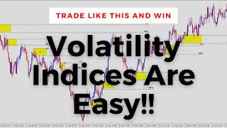 How To Trade Volatility Indices Institutional Trading Strategies [upl. by Keheley192]