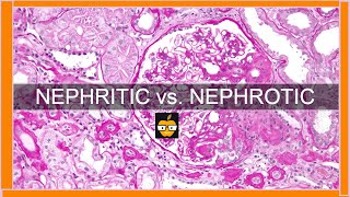 Nephritic vs Nephrotic Syndromes [upl. by Doty494]