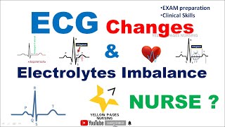 ECG changes in electrolyte imbalance [upl. by Mcripley]