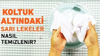 Koltuk Altındaki Sarı Lekeler Nasıl Temizlenir [upl. by Graf]