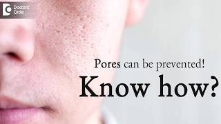 How to prevent pores on face  DrKC Nischal  Doctors Circle [upl. by Clougher962]