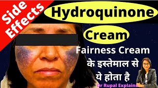 HYDROQUINONE CREAM SIDE EFFECTS  Melacare Forte Cream Over Dose से नुक़सान  Dr Rupal Explains [upl. by Onoitna]