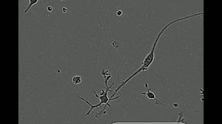 Cell Motility of Microglia Cultured in TIC [upl. by Atnoed706]