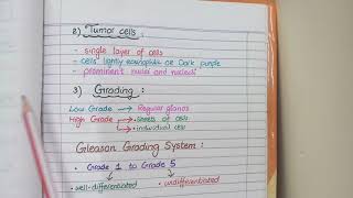 Prostate Carcinoma Pathology  Morphology and Gleason Grading [upl. by Etnod]