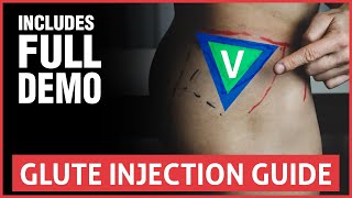 How To Do A Glute Injection  Full Guide And Demo [upl. by Botzow]