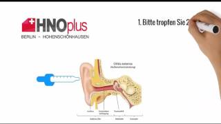 Behandlung einer Gehörgangsentzündung [upl. by Vookles]