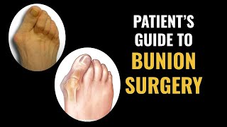 Patients Guide to Bunion Surgery [upl. by Hose]