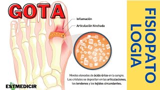 FISIOPATOLOGÍA GOTA  Dr Tlatempa [upl. by Ardnuassac]