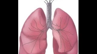 BREATH SOUNDS Stages of Fluid Overload Pneumonia [upl. by Franklin]