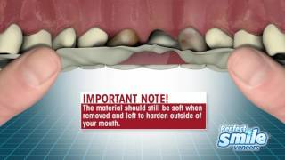 Perfect Smile Veneers Instructional  Getting Started [upl. by Socher]