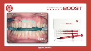 Ultradent Opalescence Boost Whitening [upl. by Rochelle]