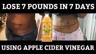 HOW I LOST 7 POUNDS IN 7 DAYS USING APPLE CIDER VINEGAR [upl. by Adrell]