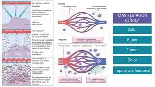 Fisiopatología  Inflamación [upl. by Adnir71]