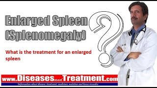 Enlarged Spleen Splenomegaly What is the treatment for an enlarged spleen [upl. by Svirad964]