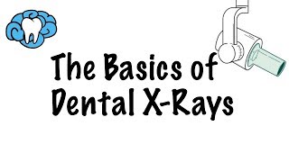 How to Read Dental XRays [upl. by Leile]