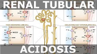 Renal Tubular Acidosis [upl. by Aikem960]