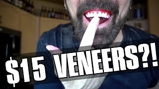 Perfect Smile Veneers Review 15 Veneers [upl. by Casavant304]