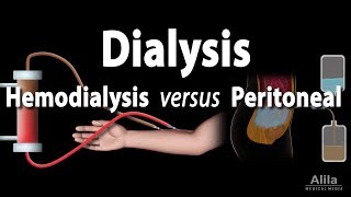 Renal Replacement Therapy Hemodialysis vs Peritoneal Dialysis Animation [upl. by Gasparo]