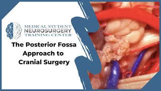 The Posterior Fossa Approach to Cranial Surgery [upl. by Jovia]