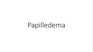 Papilledema  Ophthalmology [upl. by Allecsirp]