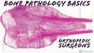 Bone Tumor Pathology Basics Medical Students Orthopedic Surgery USMLE Board Review [upl. by Eissej68]