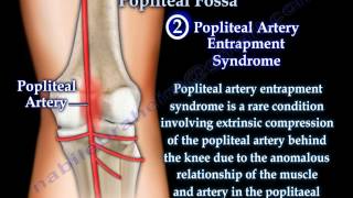 Anatomy Of The Popliteal Fossa  Everything You Need To Know  Dr Nabil Ebraheim [upl. by Ringo]