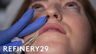 I Got Lip Filler Injections For The First Time  Macro Beauty  Refinery29 [upl. by Madelle362]